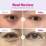 Dr.Melaxin Calcium Intense Cream Dr.Melaxin
