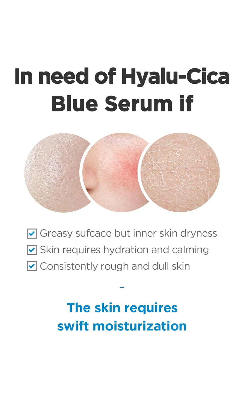 SKIN1004 Madagascar Centella Hyalu-Cica Blue Serum 50ml SKIN1004