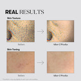 VT COSMETICS TX-TONING ESSENCE 2000 SHOT VT COSMETICS