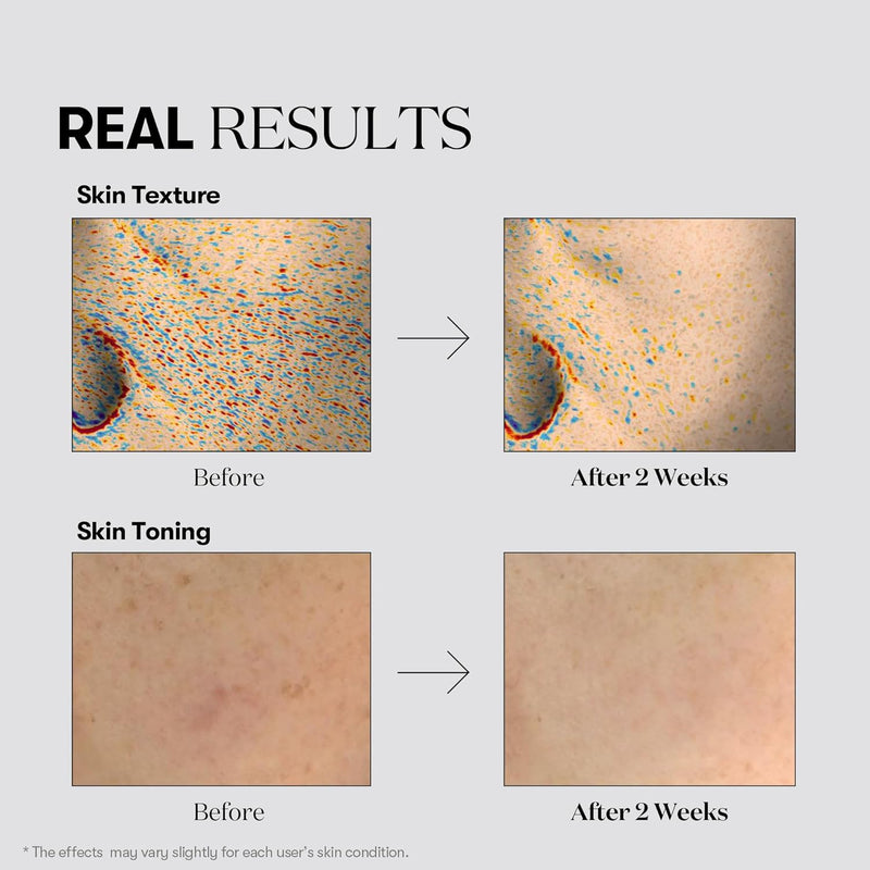 VT COSMETICS TX-TONING DAILY MASK VT COSMETICS