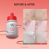 Dr.Ceuracle AZELAIC 10 & MADECA AMPOULE Dr.Ceuracle