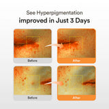 Abib Glutathiosome Dark Spot Serum Vita Drop Abib