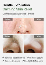 celimax Ji Woo Gae Heartleaf BHA Peeling Pad celimax