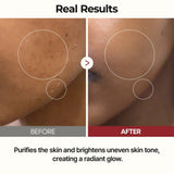 Dr.Melaxin PEEL SHOT GLOW WHITE RICE TONER Dr.Melaxin