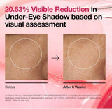 Anua Niacinamide 5 TXA Brightening Pad Anua